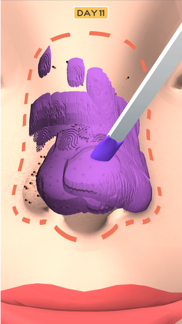 鼻子美容师游戏手机版下载图1: