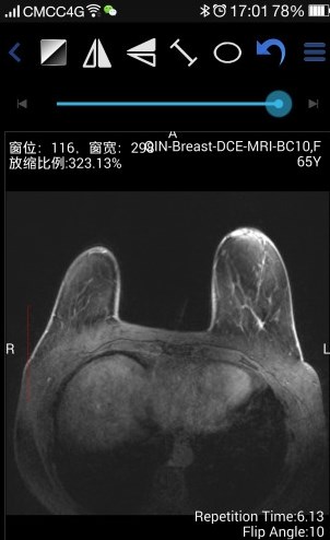 医影影像app手机版图6: