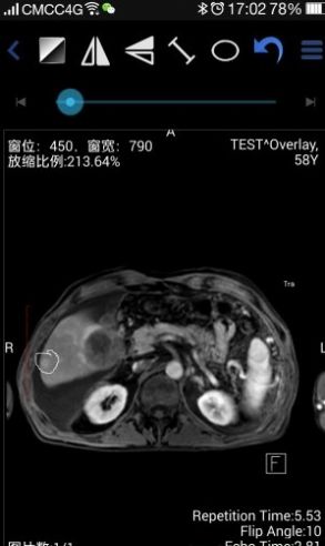 医影影像app手机版图3: