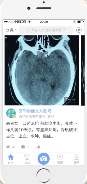 医影影像app手机版图4: